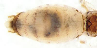 Elipsocus abdominalis
